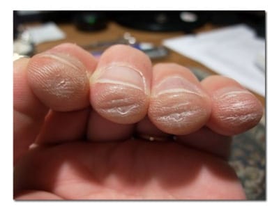 sore-beginner-guitar-fingers